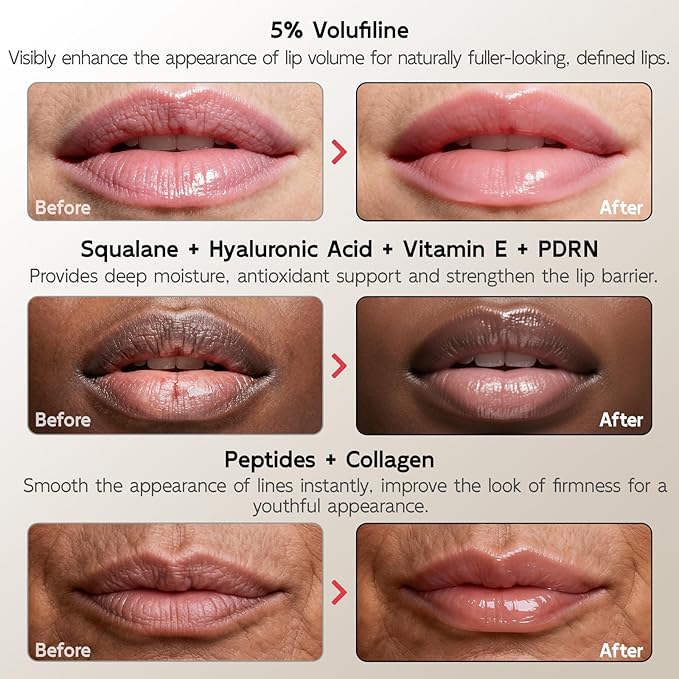YouthVibe 5% Volufiline Lip Plumper, Nourishing & Anti Aging Over Time with Squalane, Shea Butter, Collagen, Peptide & PDRN - No Burning, No Tingling for Gentle Daily Plumping
