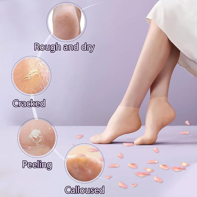 5 Pairs Silicone Socks for Dry Cracked Feet, Women's Foot Socks for Moisturizing (Beige, Fits Up to Size 11)