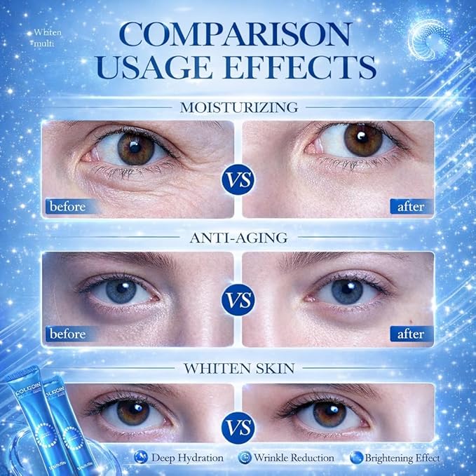 SHAIVII Collagen Eye Cream with Nicotinamide for Dark Circles & Puffiness, Under-Eye Firming Moisturizer with Hyaluronic Acid & Glycerin, Anti-Wrinkle Care for Men & Women