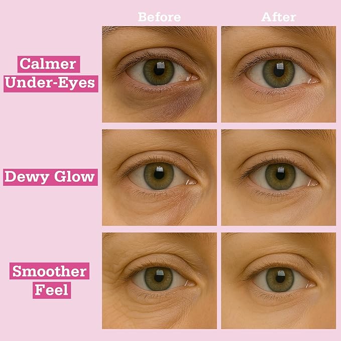 Tintark Rose Hydrogel Under Eye Patches for Dark Circles and Puffiness 28 Pairs 5 Minute Soothing Hydrating Eye Mask with Rose Extract Cooling Under Eye Pads Ophthalmologist Tested