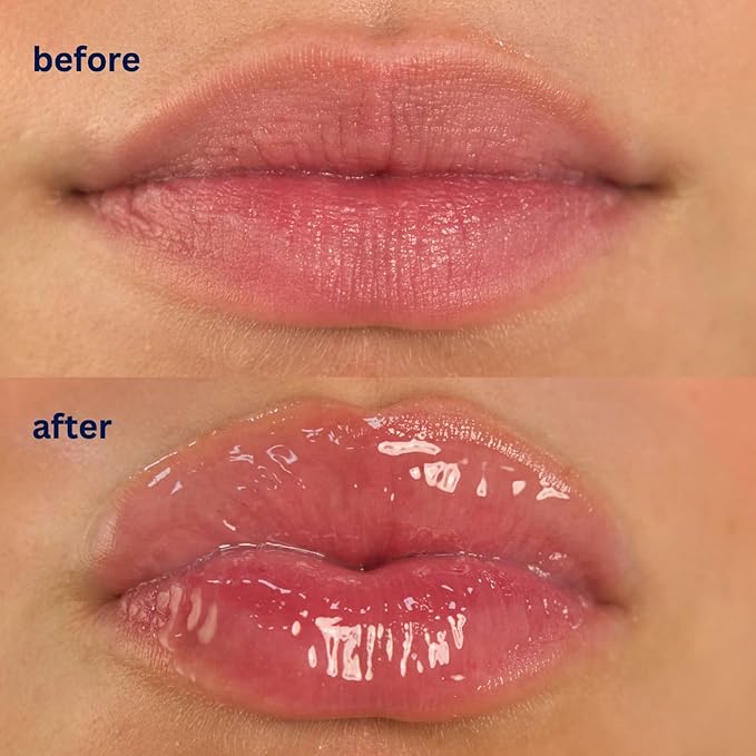 Endless Skin - Daydream - Natural Vanilla Flavor Lip Balm with Jojoba Oil, Hyaluronic Acid and Squalane - Ultra Glossy Finish that Nourishes and Hydrates Your Lips - Vegan and Paraben Free - 15ml
