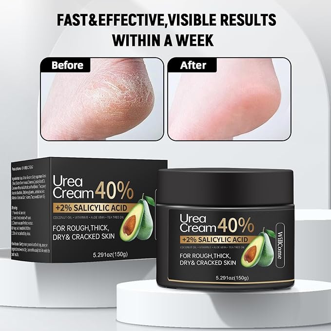Urea Cream 40 Percent for Feet Maximum Strength Plus Salicylic Acid 2%,Foot Cream for Dry Cracked Heels Feet Hands, Foot Callus Remover Gel,Urea Foot Repair Lotion,Health Care for Women&Men,150g