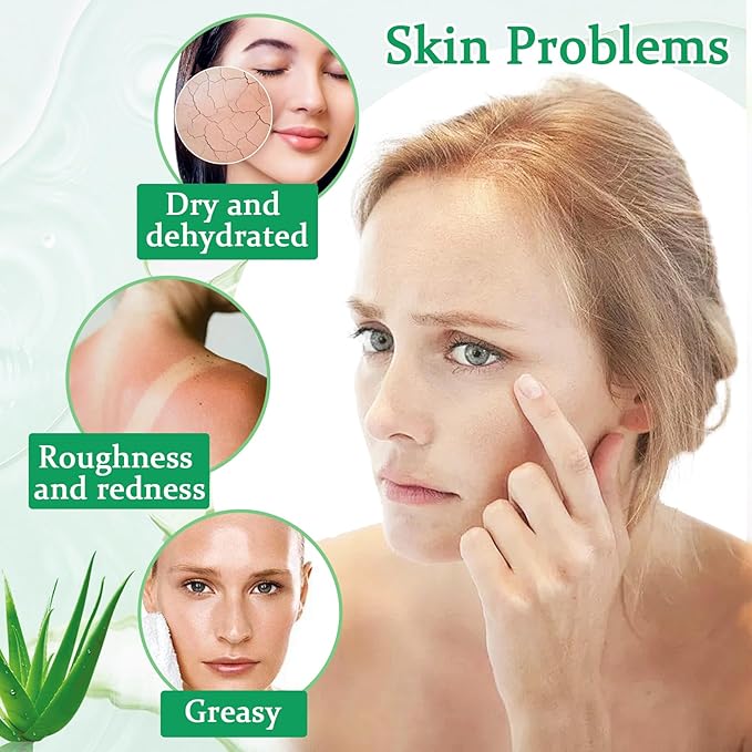 WENJLYJ 8PCS Aloe Vera Gel for Face & Skin,Organic Aloe Vera Gel,Hydrating After Sun Cream for Travel Size,Moisturizing Lotion for Skincare,After Sun Lotion for All Skin Type(E)