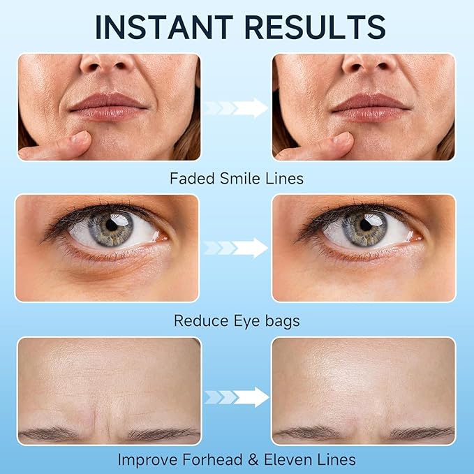 Under Eye Cream, Retinol Cream for Eye Bags and Wrinkles, Eye Bag Treatment for Men Women, Eye Cream with Caffeine for Dark Circles and Puffiness Tightener, 15ml/0.5 fl.oz