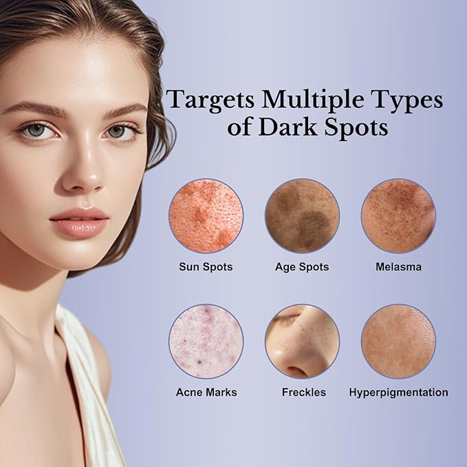 Dark Spot Remover for Face, Dark Spot Corrector - Age Spot Sun Spot Freckles Melasma Brown Spot, Natural Formula: Soothing and Repairing, Anti-Aging and Antioxidant Properties