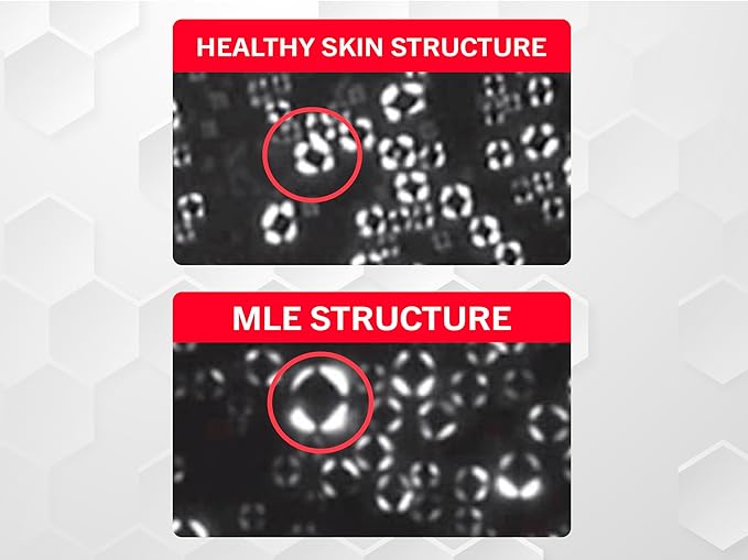 ATOPALM | Intensive Moisturizing Cream | Face & Body Moisturizer | For Dry & Sensitive Skin | Paraben-Free Lotion | Replenishes Hydration | Skin Barrier Repair | Korean Skin Care | 3.4 fl oz (100ml)