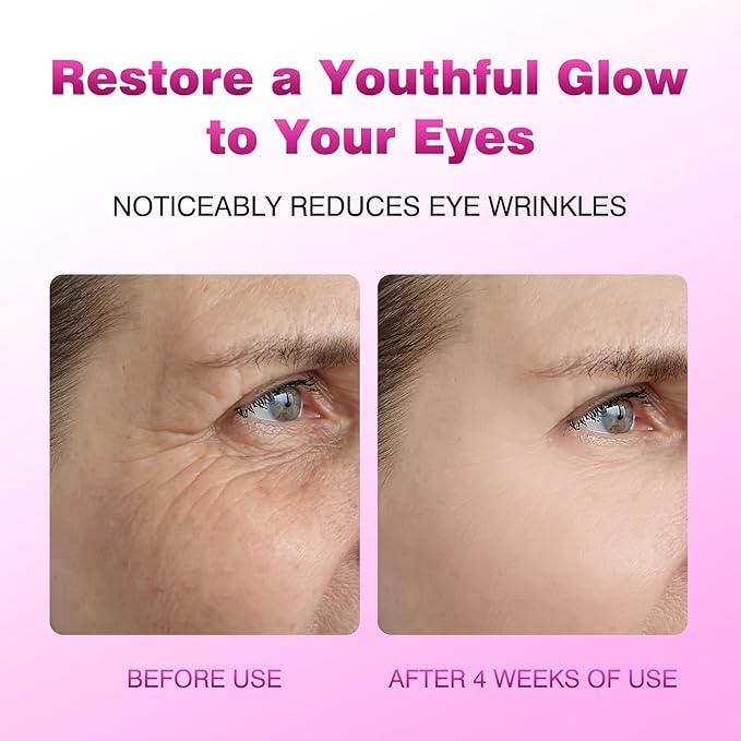 Retinol Eye Cream Balm, Hydrating Under Eye Care Daily Wrinkle Cream, Infused with Caffeine to Smooth and Hydrate Skin, Eye Cream for Anti Aging for Reduce Wrinkles, Puffiness and Bags Under Eyes