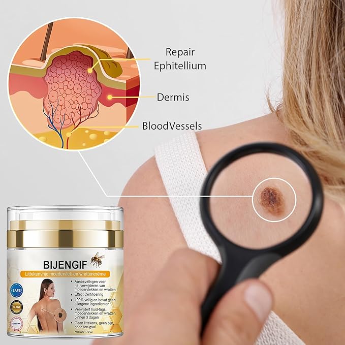 Bee venom cream for removing