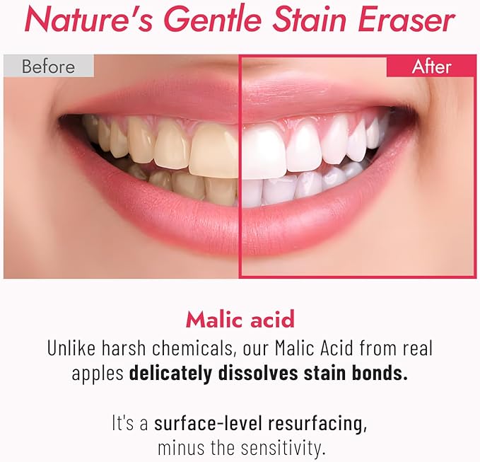 Teeth Whitening Toothpaste with Malic Acid & Niacinamide, Natural Stain Remover for Coffee & Wine, Fluoride Free, Non-Toxic, Enamel Safe for Sensitive Teeth, Gum Health Support,7.14oz