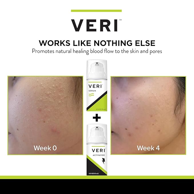 VERI Nitric Oxide + Salicylic Acid mL
