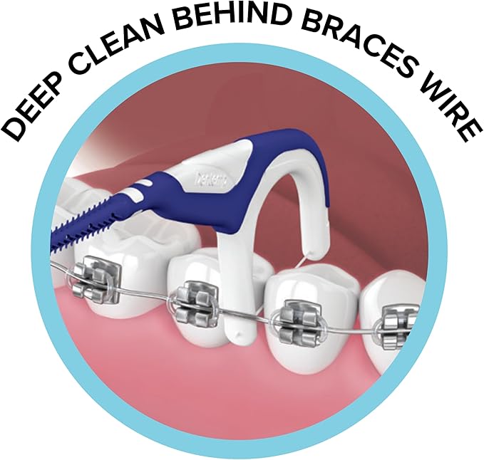 OrVance Braces Flosser - Designed for Braces for an Easy & Effective Clean, Ultra Strong Floss - 40 Count (Pack of 1) - (Packaging May Vary)