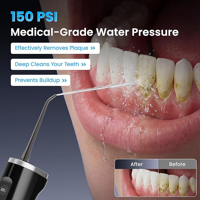 SEESMILE Water Flossers for Teeth, 100-Modes & 150-Psi High Pressure for Teeth Cleaning and Flossing, Portable Dental Floss Water Picks Cordless, 300ML & IPX7 Waterproof Flosser for Braces Kids Black