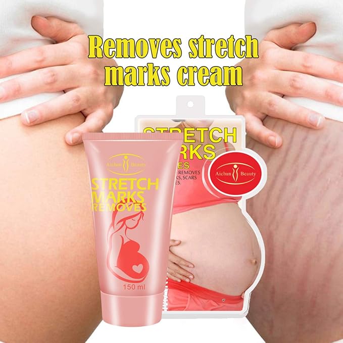 AICHUN BEAUTY Pregnancy Cream Streach Mark 150ml