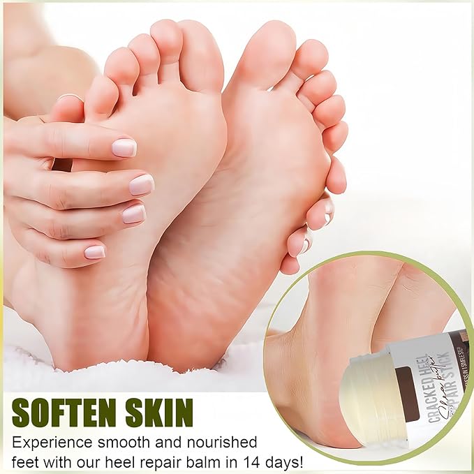 Shea Butter Hydrating Foot Cream, Coconut Nail Softening Hand and Foot Cream Balm Stick, Gentle Soften Heel Balm That Improve Dry Skin for Men Daily Skin Care, 1.41 Oz 1Pc
