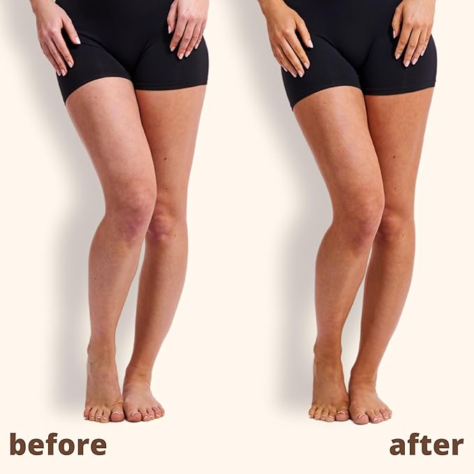 Skinny Tan Tan and Tone Self Tanning Oil Spray - No Need to Rinse - Hydrating and Toning Self Tanner for Healthier Looking Skin - Blurs Appearance of Stretch Marks - Medium Self Tan - 4.9 oz