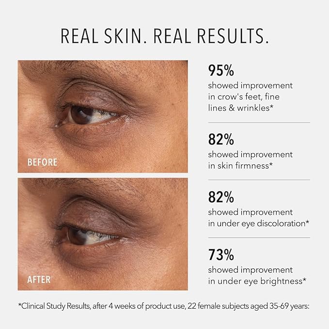 HydroPeptide : Retinol Eye Renewal Lifting & Firming Eye Balm with 0.65% Universal Tri-Retinol Complex Peptide Solution, 0.5 Ounce