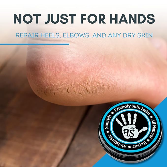 Organic Friendly Skin Balm - Organic Rock Climbing and CrossFit Hand Care for Athletes - Skin Friendly Moisturizing and Repair for Hands, Feet, Elbows and Lips