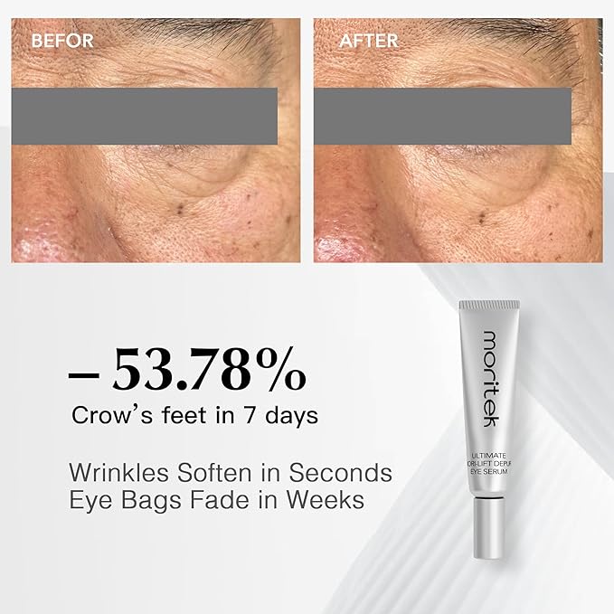 MORlTEK ultimate mori-lift depuff eye serum 9ml (3ml 3pcs)