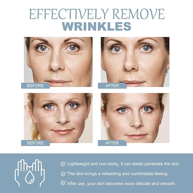 Crema de Baba de Caracol Original, Vitamin C Facial Serum 1.01 Oz, Snail Mucin 92% Moisturizer Daily Face Gel Cream1.76 Oz, Facial Cleanser 3.52 Oz for all skin type (3pcs)