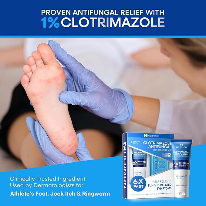 Hermon Clotrimazole Antifungal Treatment Cream & Soap Kit: Antifungal Cream for Athletes Foot, Jock Itch, Ringworm with Anti Fungal Soap - Relieves Itching Burning Cracking - 57g Tube / 113g Bar