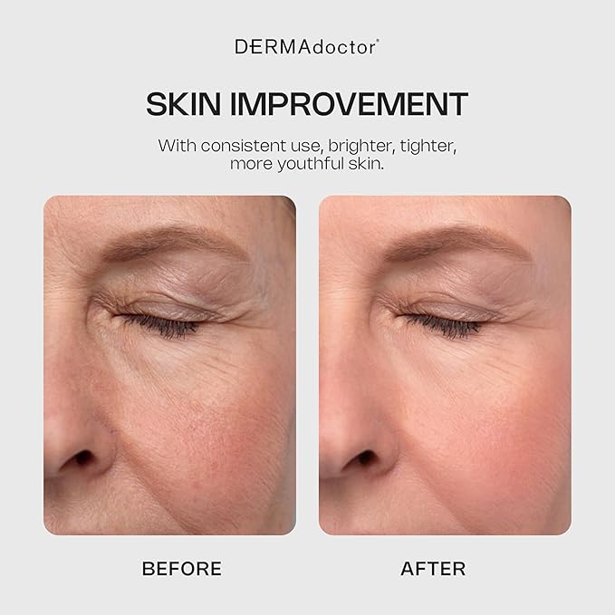 DERMAdoctor Glycolic Acid Face Wash – Exfoliating Face Wash with Antioxidants, Dermatologist Formulated Anti-Aging Facial Cleanser for Fine Lines, Wrinkles, Dullness, Uneven Skin Tone & Enlarged Pores