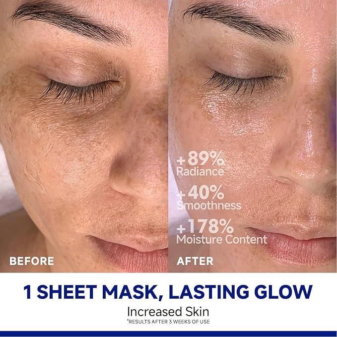 Dr Vincent Deep Hydrating Overnight Collagen Hydrogel Mask, Bio-Collagen Facial Mask for Pore-Refining Appearance & Skin Suppleness, Face Sheet Mask with Ferment Extract, Vitamin E & Peptides, 37gx5ea