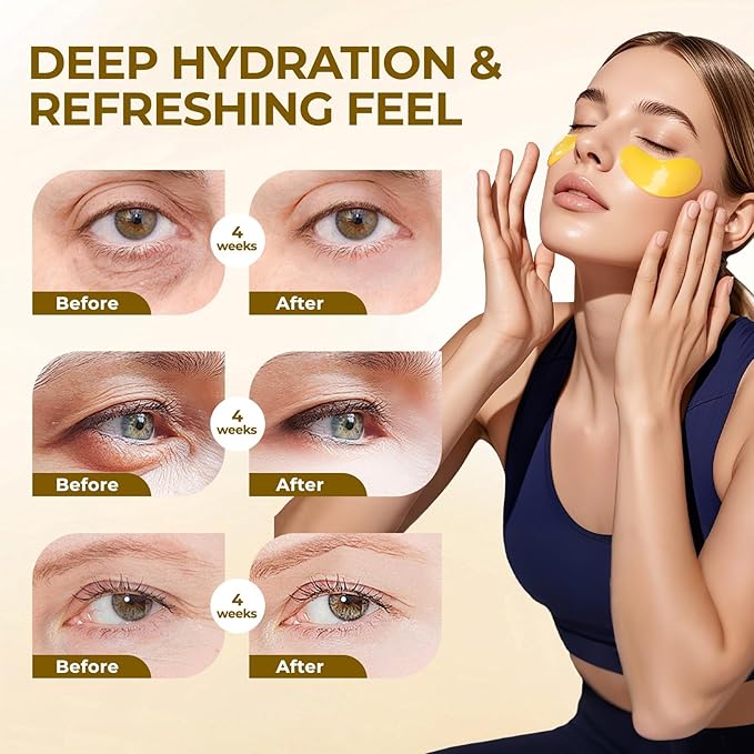 Under Eye Patches-Gold Eye Masks for Forehead Wrinkle, Puffy Eyes, Dark Circles, Eye Bags Hydrating Gel Patches, Birthday Gifts for Women Men Girls Teenage Self Care