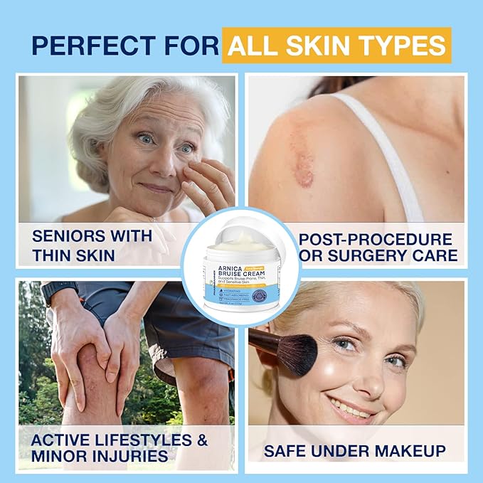 PHARMBANNER Arnica Bruise Cream Extra Strength – Fast-Acting Arnica Montana with Vitamins K, C & E for Bruising, Swelling, Discoloration & Thin Skin – Hydrating Moisturizer for Face & Body – 4 oz