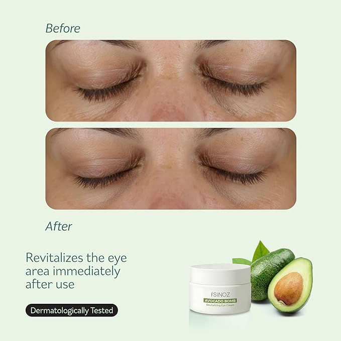 sinoz Avocado Caffeine Eye Cream for Dark Circles & Puffiness, Lightweight Under Eye Moisturizer, Vegan Daily Care, 0.5 fl oz (15 ml)