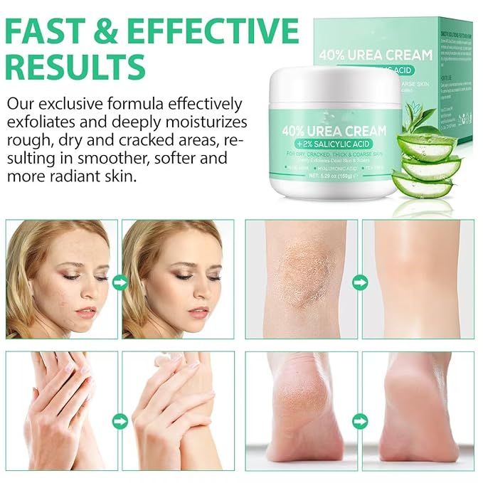 Urea Cream 40 Percent, 40% Urea Cream Plus 2% Salicylic Acid for Feet Maximum Strength, Deeply Moisturize, Repair Dry, Cracked, Rough Skin of Heel, Elbow and Knee, Foot Cream and Hand Cream