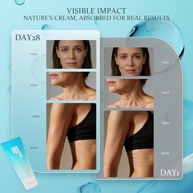 NIAWIT Advanced Crepey Skin Wrinkle Repair Cream – Anti-Wrinkles for Crepey and Sagging Skin – Firming Moisturizer for Body, Neck, Chest & Face – 100g