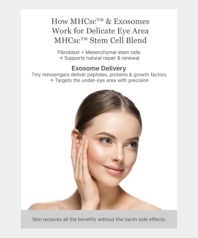 Keracell Eye Cream Anti Aging Solution – 8-in-1 Renew Cream with MHCsc Technology – Under Eye Cream for Dark Circles - Reduces Puffiness, Fine Lines, Wrinkles – With Peptides & Cucumber - 0.5 oz
