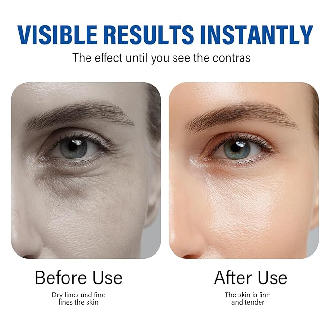 ITECFREELY Instant Eye Tightener, Perfection Eye Tightener Cream for Under Eye Bags & Fine Lines, Hydrating & Non-Greasy, Easy-Wear for All Skin Types