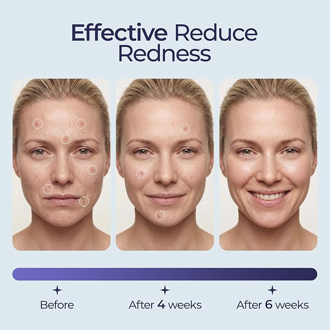 ECOLOOK Disposable Face Towel XL-60 Count Upgraded Thick Facial Towels, Ultra Soft Clean Face Towels Disposable, 10"x12" & 90 GSM, Ideal for Sensitive Skin-1 PACK