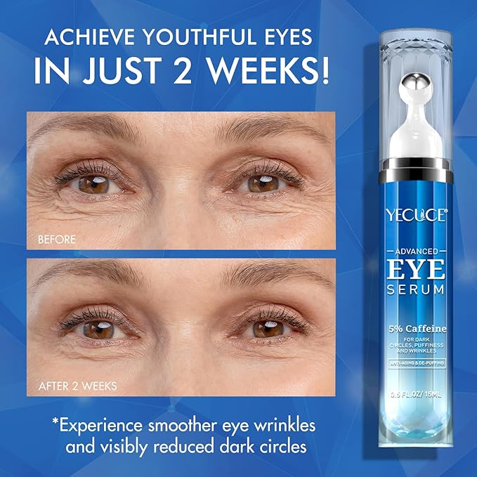 5% Caffeine Eye Serum for Dark Circles & Puffiness, Under Eye Serum with Retinol, Hyaluronic Acid & Niacinamide, Cooling 360° Roller Eye Treatment for Fine Lines, 0.5 fl oz
