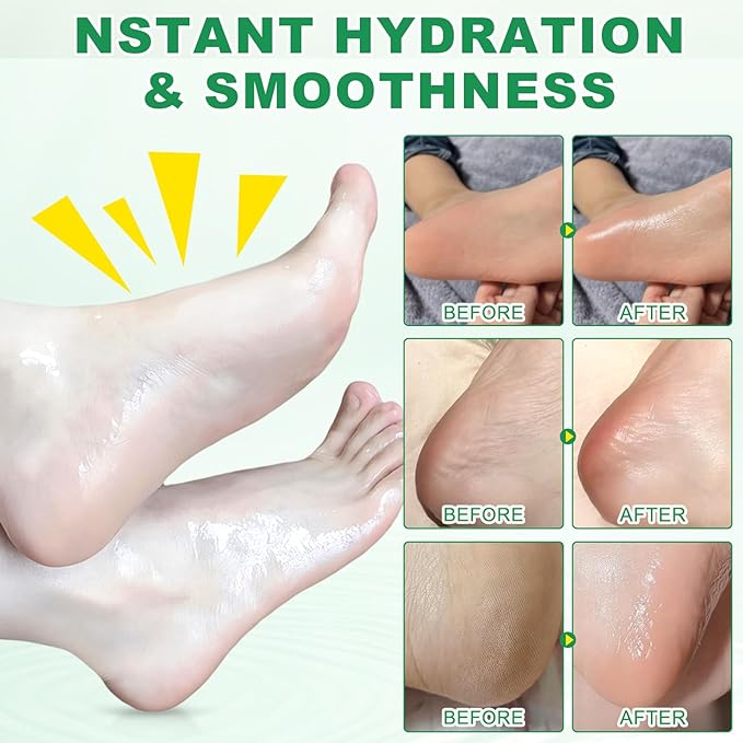 Peach+Aloe Scent Urea Cream 60% Plus Salicylic Acid 2% Foot Balm Stick for Chapped Heel, Dry Cracked, Skinned knees, Hand Intensively Hydration/Moisturization, Callus Removal/Softening, 40g+40g