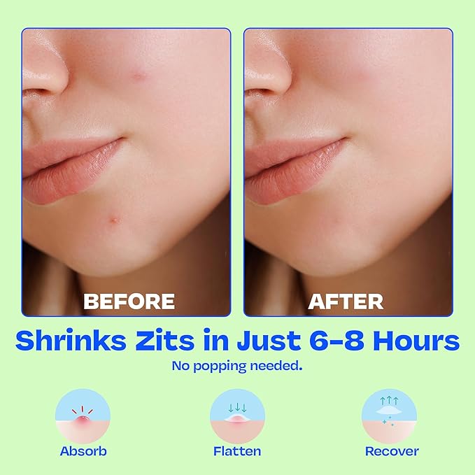 JB SKRUB The Pimple Patches for Face, Ultra Discreet Clear Hydrocolloid Patches with Salicylic Acid & Niacinamide, Skin Care for Kids & Teens - 3 Packs of 25 Small, Medium & Large Spots