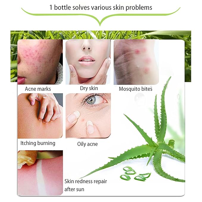 ASYBO 300 ML Natural Aloe Vera Gel -Organic Moisturizing Cream, Soothing and Hydrating, Sunburn and Scar Repair, Care for Face Body Hair