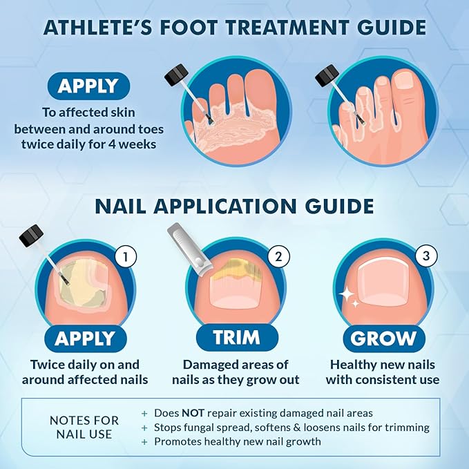 Ebanel Athletes Foot Treatment Extra Strength, Antifungal Cream for Foot Fungus, with Miconazole, Undecylenic Acid & Tea Tree Oil, Fast Itch Relief, Treats fungal Infection Leading to toenail Fungus