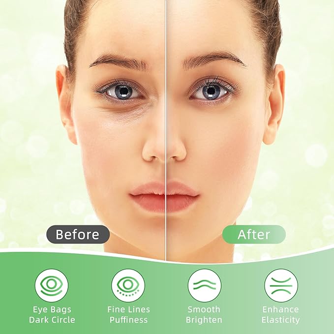 USTELIR Under Eye Patches, 40 Pairs Eye Mask for Dark Circles, Puffy Eyes, Undereye Bags,Wrinkles,Eye Mask Patches with Aloe Vera, Eye Treatment Skin Care for Men & Women Gift