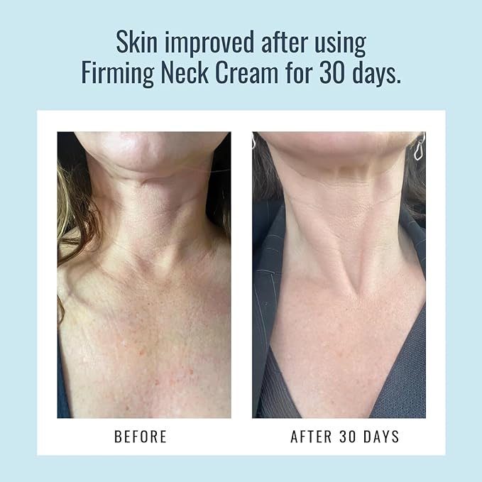 Foundation Skincare Firming Neck Cream - Firms, Strengthens, & Hydrates Crepey Skin for a More Youthful-Looking Neck & Décolletage - with Peptides & Natural Moisturizing Agents - 2 Oz