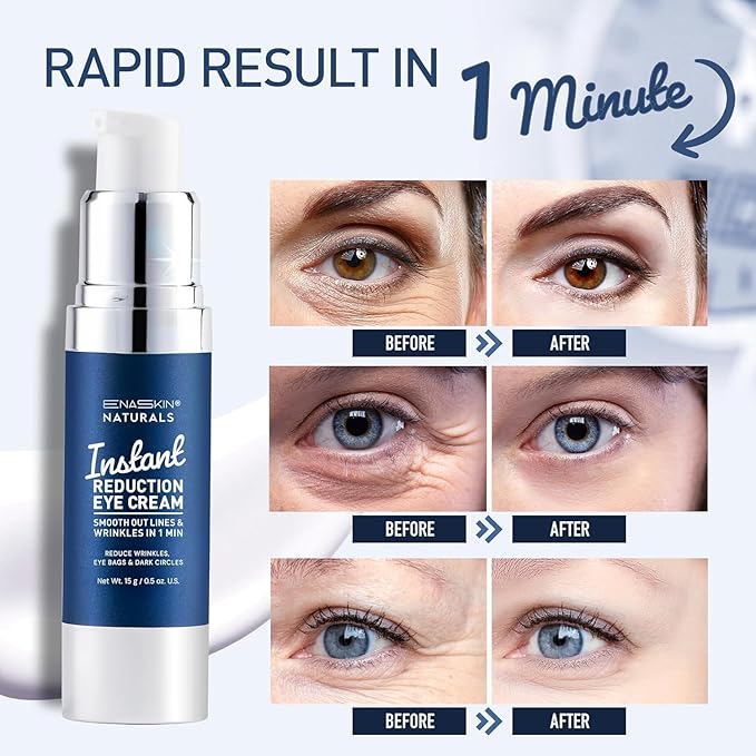 Enaskin Naturals Instant Eye & Face Lift Cream - Rapid Tightener and Wrinkle Filler for Deep Wrinkles - Under-Eye Bags & Puffiness Remover - Temporary Face Firming for Women & Men in 60s - 0.5 oz