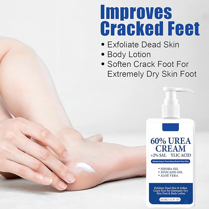 60% Urea Foot Cream – Large Size Foot & Heel Moisturizer with Jojoba Oil, Avocado Oil & Aloe Vera – Foot Lotion for Dry Cracked Feet, Hands & Elbows – 150ML/5.3oz Pump Bottle