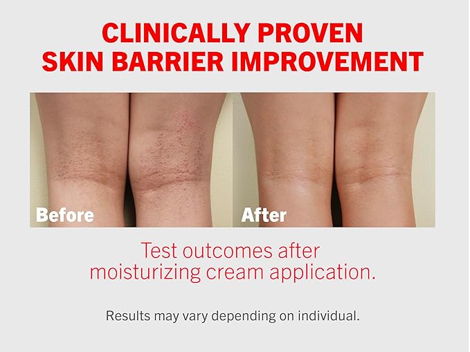 ATOPALM | Intensive Moisturizing Cream | Face & Body Moisturizer | For Dry & Sensitive Skin | Paraben-Free Lotion | Replenishes Hydration | Skin Barrier Repair | Korean Skin Care | 3.4 fl oz (100ml)