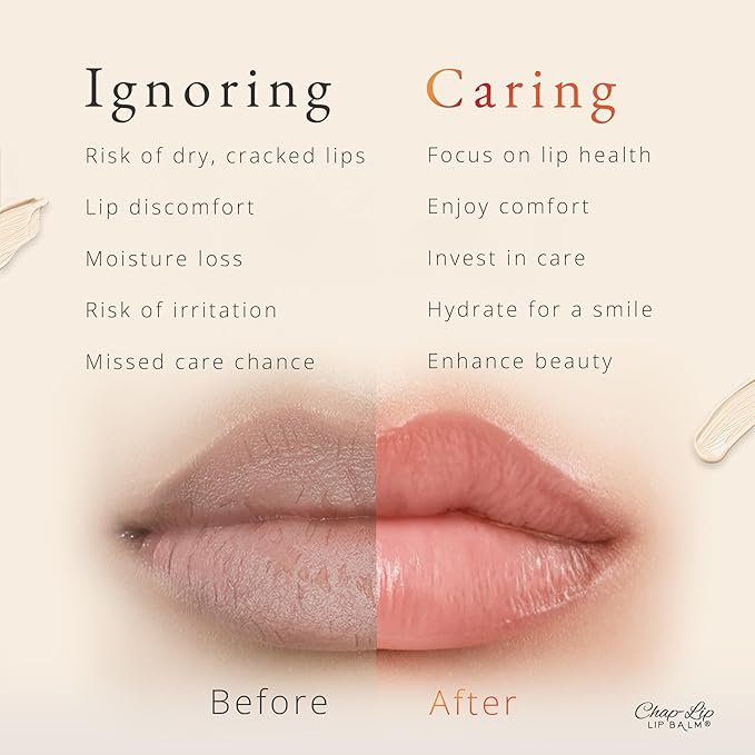 CHAP-LIP Lip Balm 48 Ct.