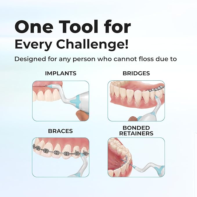The AutoFlosser Threader Dental Floss Handle Kit - Dentist Designed Manual Flosser with Ergonomic Handle for Implants, Bridges, Braces & Bonded Retainers - Starter Kit with Stiff & Thin Glide Floss