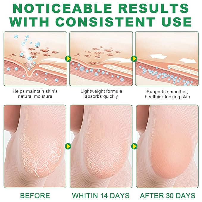 Peach+Aloe Scent Urea Cream 60% Plus Salicylic Acid 2% Foot Balm Stick for Chapped Heel, Dry Cracked, Skinned knees, Hand Intensively Hydration/Moisturization, Callus Removal/Softening, 40g+40g