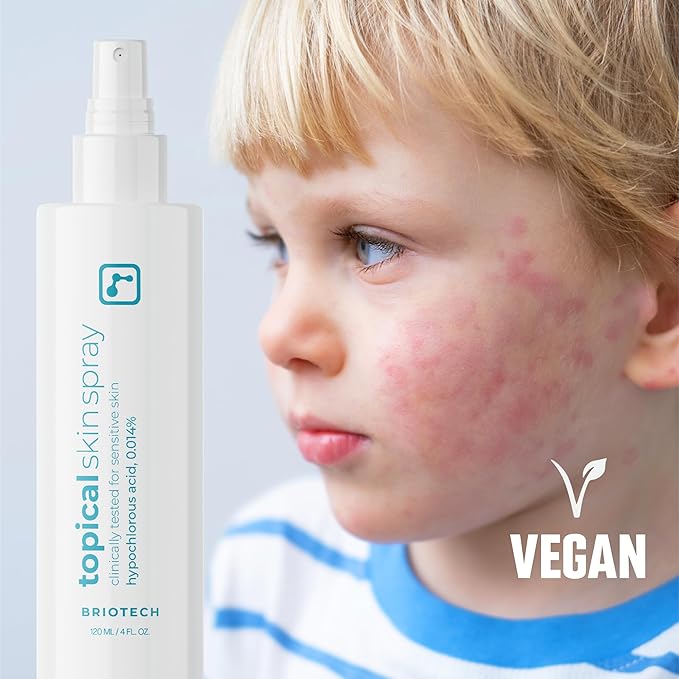 BRIOTECH Topical Skin Spray, Hypochlorous Acid Spray for Body & Face, Eyelid Cleanser, HOCl Facial Mist, Support Against Irritation, Calm Redness, Soothe Foot & Scalp, 128 fl oz (4 Pack)