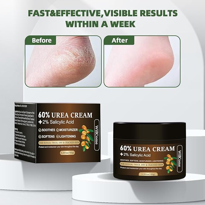 WillCome Urea Cream 60 Percent with 2% Salicylic For Feet Maximum Strength, Callus Remover Gel,Foot&Hand Care Cream Urea Lotion for Dry Cracked Heels and Feet Treatment& Repair,5.29 oz