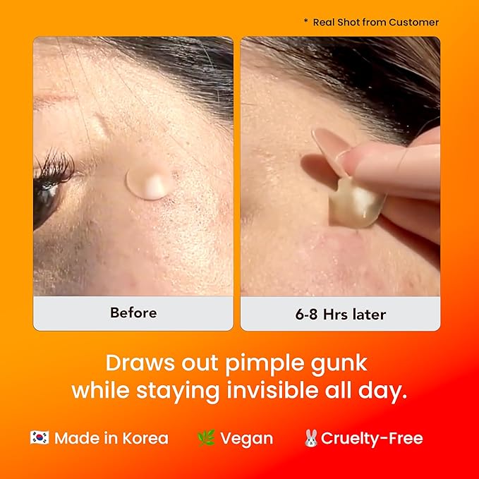 AVARELLE Acne Cover Patch Guardian – Invisible UPF 50+ Daytime Sun Guard Hydrocolloid Pimple Patches with Cica, Tea Tree & Calendula, Smart Acne Patch for Acne-Prone Skin, 40 Count